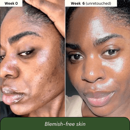 Sage & Stone Turmeric and Kojic Acid Brightening Bar - Sage & Stone